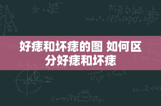 好痣和坏痣的图 如何区分好痣和坏痣